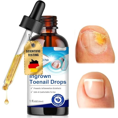 30ml Liquido Riparatore Cura delle unghie, Oli per la cura unghie incarnite, Smalto Curativo, Facile e Rapido, Senza Scolorire l'Unghia