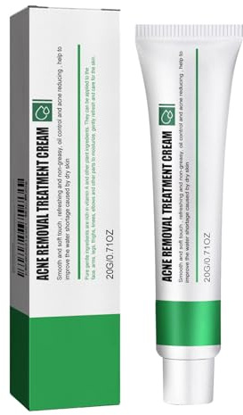 Crème éclaircissante contre les taches de rousseur et l'acné, crème pour éliminer les taches pigmentaires du visage, les taches brunes, les rides et les imperfections