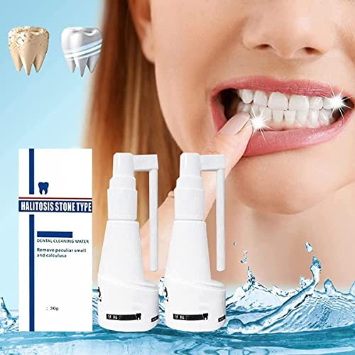 Calculusfree Spray dentale dissolvente da 30 ml, detergente per denti per la rimozione del calcolo dentale, spray rinfrescante per la bocca, dentifricio intensivo per la rimozione delle macchie,