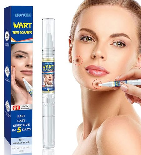 Warzen und Warzenentfernungsstift, 2 in 1 Warzen und Warzen für alle Hauttypen, Fuß und Handwarzenentferner