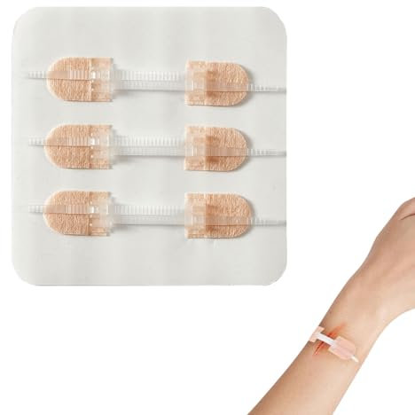 Wundnahtstreifen,Wundverschlüsse Strips, Klebebandagen,Wundnahtstreifen-Strips Klammerpfla,Notfall Wundverschluss,Erste Hilfe & Sicherheit Für Camping & Outdoor, Für Frauen Männer