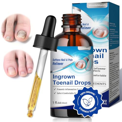 30ml Nagelpflege Flüssigkeit für Zehennägel, Nagelpflege pflegend, Fur pflege Gebrochene und Verfärbte Zehennägeln, Schutz & Stärkung Nagelhaut,gesunde Fuß und Hand