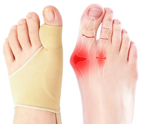 CFYHXY 1 Pair Bunion Corrector Big Toe Straightener with Heel Strap (Beige) | Big Toe Protector & Broken Toe Support. Soft Hallux Valgus Socks for All-Day Comfort, Gel Separator Reduces Friction
