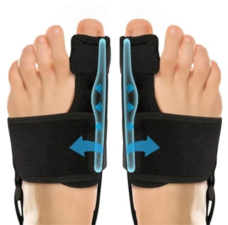Generico Ortolex Valgux Tutore, 1 paio di stecche correttive per dita dei piedi, Correttore dell’alluce valgo (Hallux Valgus) separatori regolabili unisex, protezioni per alluce e dita