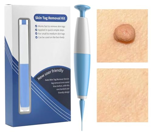 Eliminador de Verrugas Facial - Removedor de Callos Plantares - Kit Extractor de Granos Seguro para Uso en Casa en Pies, Manos, Dedos, Cara, Cuerpo, Orejas y Piernas