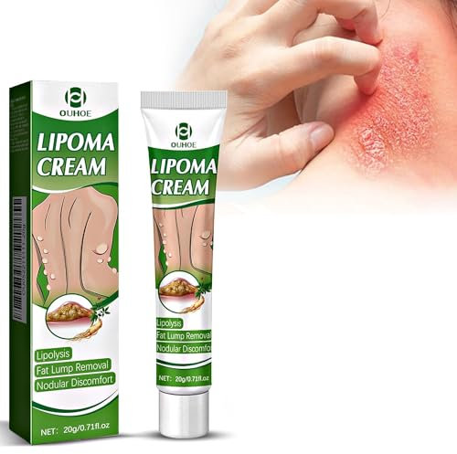Crema Antifúngica 20g, crema antifúngica para la piel Alivia el picor inguinal, tiña, eczema, Antifúngico, Descamación, Alivia Rápidamente los Irritación Y Enrojecimiento en el Cuerpo Y la Cara