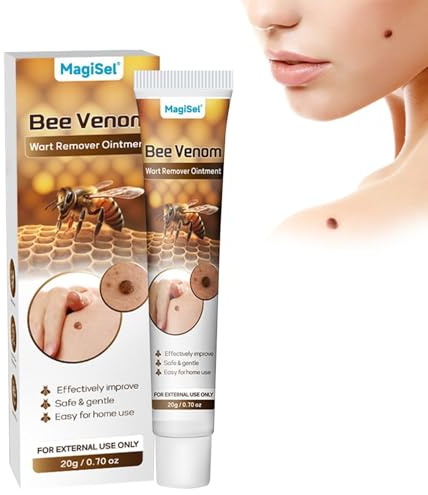 Warzenentfernungscreme, Geeignet zur Warzenentfernung, Bee Venom Cream Bienengift Warzen und Etikettenentferner für Arm Taille Füße Bein Alle Hautt