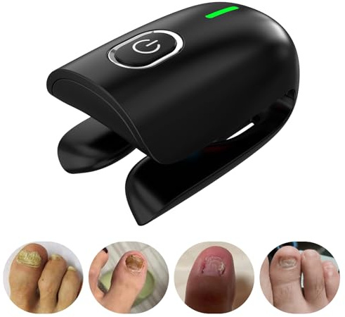 LaseLocks Nagelpilz Laser Behandlung Gerät, Tötet Pilz in den Nagel und tiefen Schichten der Haut, Wiederaufladbare tragbare Laser Therapie Gerät