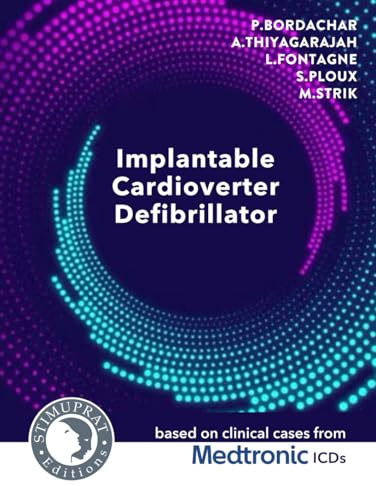 Implantable Cardioverter Defibrillator: based on clinical cases from Medtronic ICDs