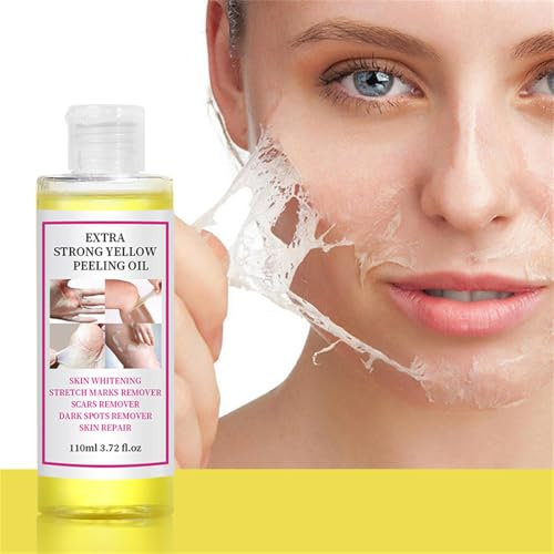 Aceite exfoliante, aceite exfoliante extra fuerte, aceite exfoliante amarillo para piel oscura, solución exfoliante para cuerpo, manos, pies y cara, todo tipo de piel (110 ml/3,72 fl oz) (amarillo, 4
