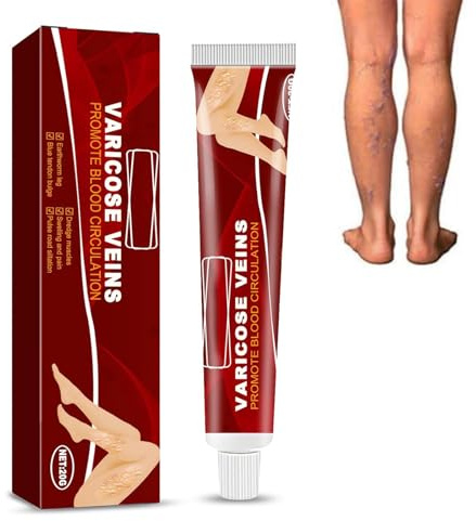 Grgowe Crème Contre Les Varicosités,Varicose Vein Repair Cream,Réparation Des Jambes D'Araignée,Traitement Des Varices Pour Les Jambes,Crème Anti-Varices Apaisante Pour Les Jambes