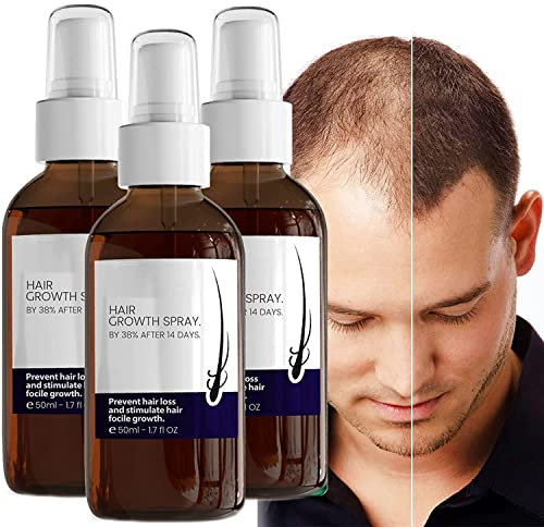 Pelinuar Blusoms Hair Growth Formula Serum Spray, Ashwagandha 4500, Anti Haarausfall Serum für alle Haartypen, Uni-Erwachsene