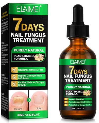 Ginger Nail Treatment, Natural Plant Formula Nail Growth Serum, Ginger Cuticle Care Oil for Strengthen & Promote Nail Growth & Repair Nutrient Oil (1PC)