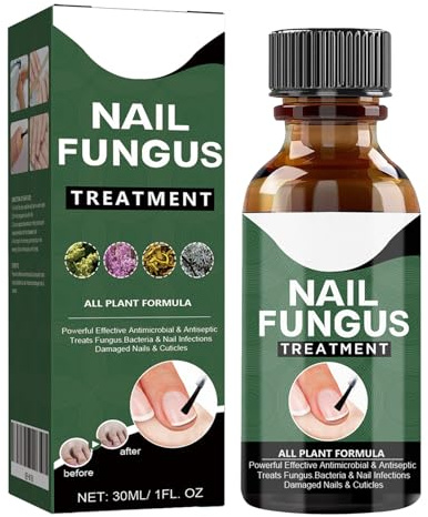 KOAHDE Funghi Unghie Trattamento,Rinforza la Struttura Dell'Unghia,Soluzione per La Riparazione delle Unghie del Piede,Liquido per Infezione delle Unghie,30ML