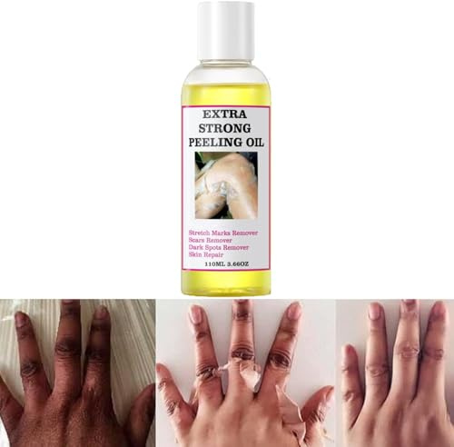 Peeling Oil, Extra Strong Peeling Oil, Yellow Peeling Oil for Dark Skin