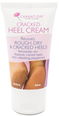 CARNATION FOOTCARE Cracked Heel Cream, Revives Rough, Dry and Cracked Heels, Moisturises, Rehydrates Dry Callused Feet with Refreshing Peppermint Oil with 20% Urea, 50ml