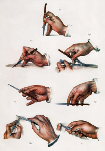 ML07 Vintage 1800's Medical Scalpel Surgical Techniques Anatomical Anatomy Poster Re-Print - A3 (432 x 305mm) 16.5 x 11.7