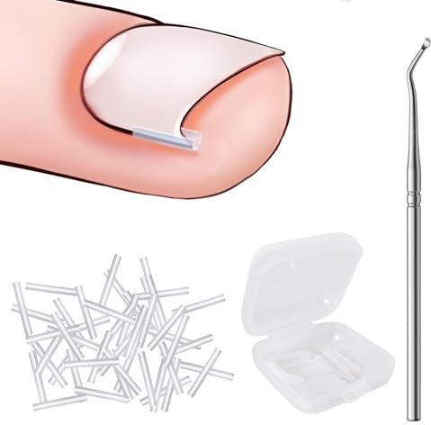 40 Piezas Corrector de Uñas de Los Pies, Corrector Uñas Encarnadas Pies, Levantadores de Uñas Encarnadas, Kit de Herramientas para Uñas Encarnadas, Tratamiento Uñas Encarnadas
