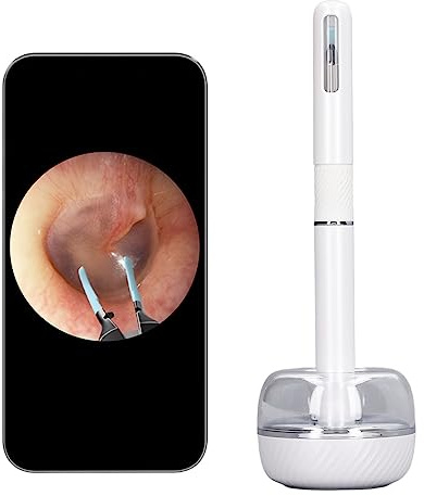 Herramienta de Eliminación de Cera de Oídos, Limpiador de Oídos con Cámara y Luz LED, Otoscopio de Cámara de Oído, Removedor de Cera de Oídos de Gran Angular de 10 MP y 360 Grados (Blanco)