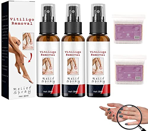 Vitiligoremoval Relief Spray, Vitiligo Removal Relief Spray, Vitiligo Treatment Spray, Vitiligo Skin Repair Spray, Vitiligo Care Spray zur Hautpflege, Reduziert weiße Flecken auf der Haut (3)