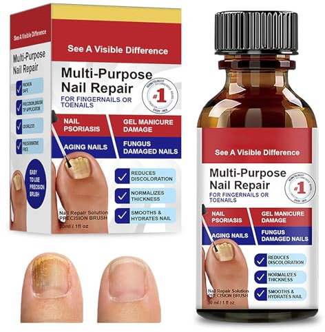 30 ml Nagelhärter Nagelaufbauserum Nail Repair, Schützender Nagelhärter,Nagelhärter fur Brüchige Nägel, Fuß Flüssigkeit für Fingernägel und Fußnägel Nagelpflege