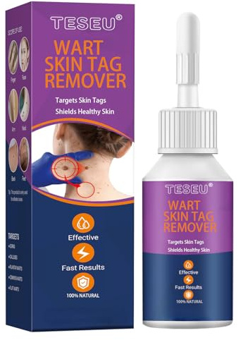 Wart Remover, Wart Removal, Verruca Remover, Fast Effective Skin Tag Removal for Common Warts, Plantar Warts, Corn and Calluse, Suitable for All Body - Purple