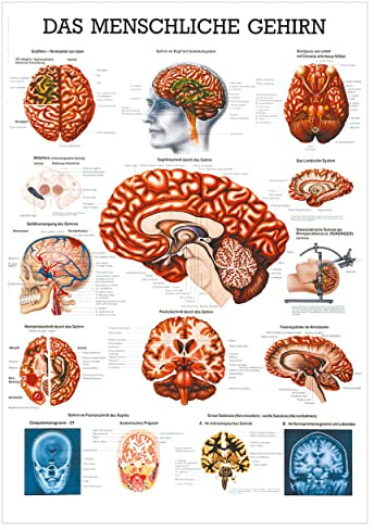 Rüdiger Das gehirn Lehrtafel Anatomie 100x70 cm medizinische Lehrmittel