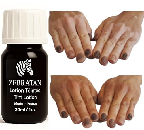 Vitiligo Makeup Lotion 30 ml - maskerar vita fläckar på huden - naturlig, icke-fet kamouflage inte foundation - män, kvinnor och barn - självbruten, vegan - mellanbrun nyans
