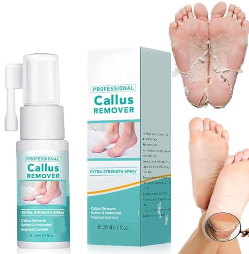 Professioneller Hornhautentferner, extra starkes Spray, Fuß-Hornhautentferner-Spray, Fuß-Peeling-Spray, Öl zum Entfernen abgestorbener Haut und Schwielen an den Füßen (1 Stück)