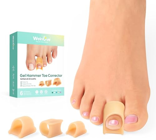 Welnove separadores de dedos de los pies - 6 pcs corrector de dedo martillo - Gel suave separador dedos pie silicona - Realinea dedos torcidos, encorvados, en garra para Unisex(2L+2M+2S, Beige)