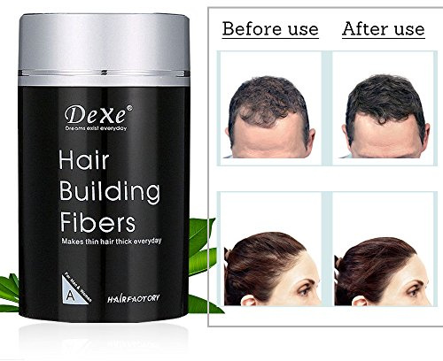 Hair Building Fibers, Fibras Capilares Castaño Oscuro, Fibras de Cabello Naturales,Fibra Capilar para Engrosamiento de Cabello, Disimular Calvicie Con Polvo de Queratina Hair Building (Negro)