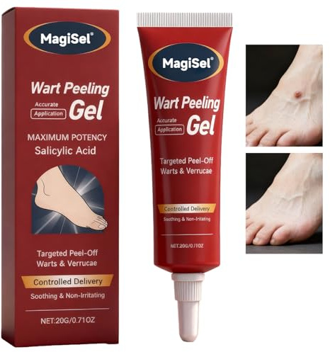 Verruche Rimozione Crema, Verruca Rimozione Della Pelle, Crema Per Il Sollievo Di Verruche, Sicuro Per La Pelle Sensibile, Rimoziones Delle Verruches pers Mani, Viso e Corpo 20G