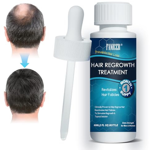 60ML Haarwachstum Serum, Hair Growth Serum bei Haarausfall, Kopfhaut Nährt, Geschenke für Männer und Vater, Kopfhaut Pflege Fördert Dickeres Haar,