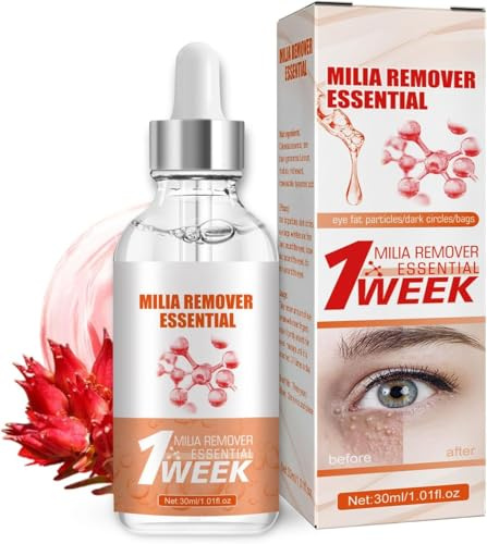 Milia Siero per rimuovere gli occhi - Siero viso contro milie e macchie scure, contro le borse per gli uomini e le donne, riduce la pelle flaccida, gonfiore e linee sottili, 30 ml (1PCS)