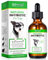 JSBNQRMZ Natural Antibiotics for Dogs,Dog Antibiotics Drops,Dog Itch Relief Pet Antibiotics-Supports Dog Allergy Relief,Anti-Bacterial Effect,Dog Multivitamin (60ML)