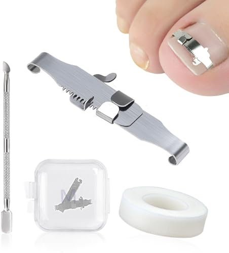 EUYKQNOI 2Pcs Strumenti Per Unghie Incarnite, Fibbia Per Correzione Delle Unghie Dei Piedi Incarnite e Trattamento Della Paronichia, In Acciaio Inox Chirurgico