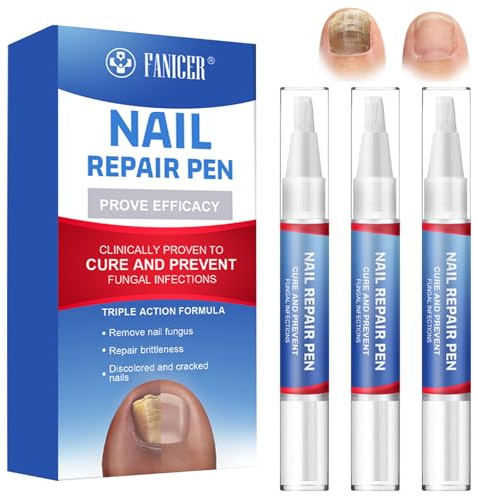 4 Pezzi Nail Care Pen,Penne Riparazione Unghie,Penne per la Cura delle Unghie Idrata e Rinforza le unghie,Nail Moisturizer olio per riparare Cracked e Secca,Facile da usare