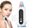 Skin Scrubber, Ultraschallpeelinggerät für Gesicht, Ultraschall Peeling Mitesserentferner Porenreiniger Akne-Entferner, Ionen Hautreiniger mit 5 Modi für Gesichtsreinigung Gesichtspflege