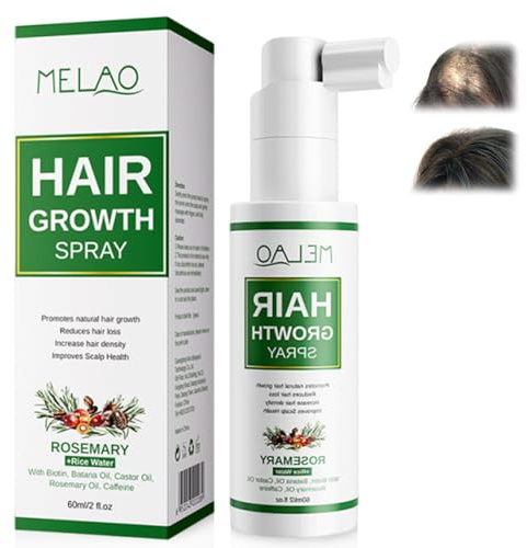 60ml Sérum Cheveux,Spray pour la Renforce Rapide des cheveux,Hair Spray,pour Fortifier et À Favoriser La Densifie hair,Nourrir le Chevelu,Convient Aux Hommes et Aux Femmes