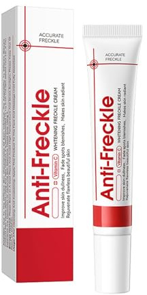 Crème blanchissante pour le visage, les taches brunes et les taches blanchissantes, pigment anti-âge, anti-pigment et anti-âge, anti-décoloration et crème, 20 g