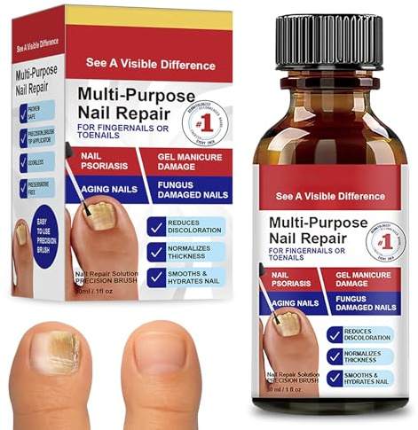 30ml Reparadores de Uñas Solución,Tratamiento hongos uñas pies – efectiva que combate la decoloración,Solución Multiusos para Uñas Decoloradas, Uñas Dañadas y Uñas Gruesas de los Pies