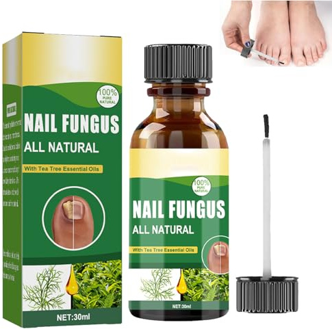 Fungo Unghie Piedi,Soluzione per La Riparazione delle Unghie del Piede,Soluzione per la Cura Delle Unghie,Trattamento Antimicotico,Liquido per Infezione delle Unghie,Nail Fungus Solution