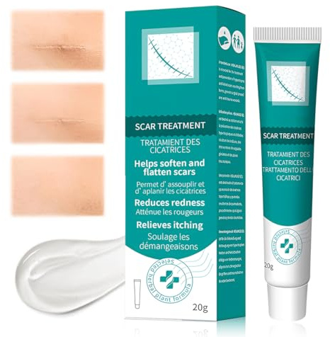 LAKPYN 20g Gel Di Eliminazione Della Cicatrice,Crema Per Cicatrici,Unguento Cicatriziale,Per Cicatrici,Gel Cicatriziale Di Alta Qualità,Crema Che Riduce La Visibilità