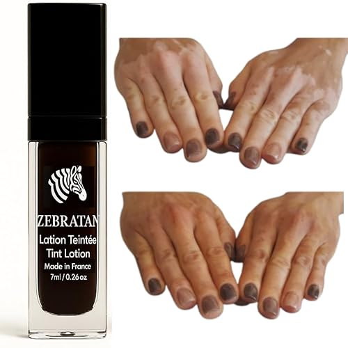 Vitiligo Makeup Lotion 7 ml - maskerar vita fläckar på huden - naturlig kamouflage inte fet foundation - män, kvinnor och barn - obronzant, vegan - mellanbrun nyans