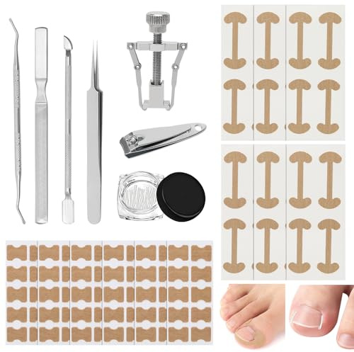 Invuxna tånaglar set, 120 delar tånagelkorrigeringsset | Med 60 korrigeringslappar, 24 böjda plåster, 30 C-formade nagelkuddar och 6 rostfria verktyg för fotnagelvård