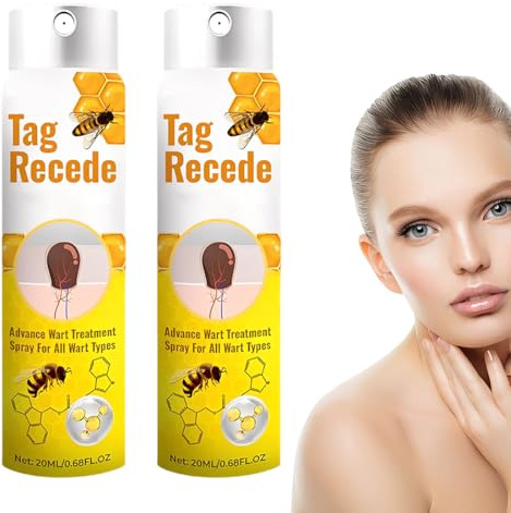 SUJEBKC 2pcs Veleno D'Api,20ml Trattante Al Velenos D'Api,Al Veleno D'Api Per Verruche Per Tutti I Tipi Di Pelle