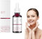 AHA 30% + BHA 2% Peeling Solution 30ml,Fruchtsäurepeeling Gesicht,Peeling-Lösung Fruchtsäureessenz Flüssige,Gesichtsserum,Alle Hauttypen