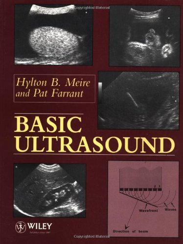 Basic Ultrasound (English Edition)