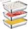 VOHESEA Panierschalen Set 3 Teilig, Schale zum Panieren mit Panierzange, 25x19x5cm Edelstahl Panier Set, Stapelbar Panierstrasse zum panieren für Fisch, Fleisch, Gemüse