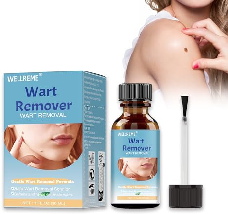 Wart Remover, Fast-Acting Skin Tag Removal Kit Care for Wart Removal on Hands and Body, Suitable for Various Skin Types (30ml)
